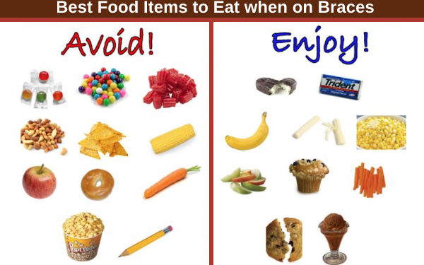 Foods You Can And Cant Eat With Braces Stavya Dental Clinic 