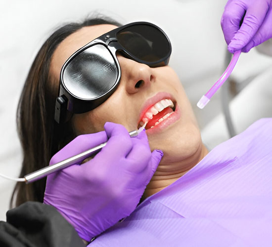 Laser Treatment