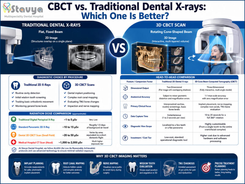 CBCT vs. Traditional Dental X-rays