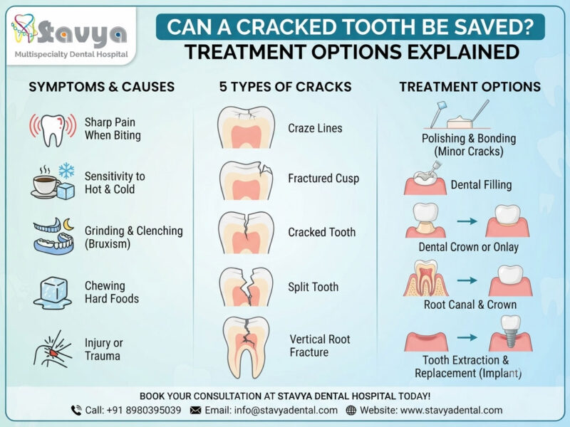 Can a Cracked Tooth Be Saved? Treatment Options Explained