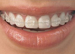 Orthodontics